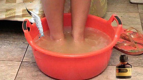 Taking a hot bath with iodine is one of the stages of treating toenail fungus