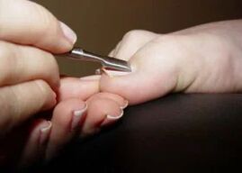 Pedicure