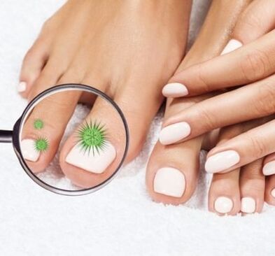 Nail infection through a magnifier