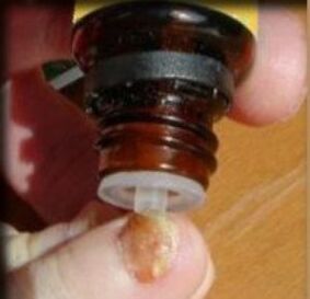 Applying drops to a fungus-affected toenail
