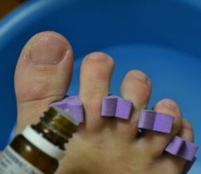 Preparing to treat nails with anti-fungal drops